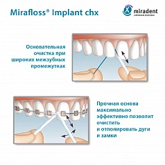 Флосс miradent Mirafloss Implant chx 2,2 мм, хлоргексидин 0,2%, для имплантов/брекетов