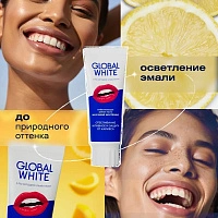 Зубная паста Global White Max shine отбеливающая,100г - изображение 5