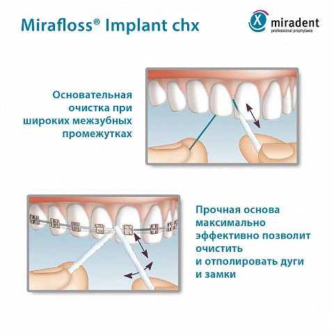 Флосс miradent Mirafloss Implant chx 1,8 мм, хлоргексидин 0,2%, для имплантов/брекетов - изображение 3